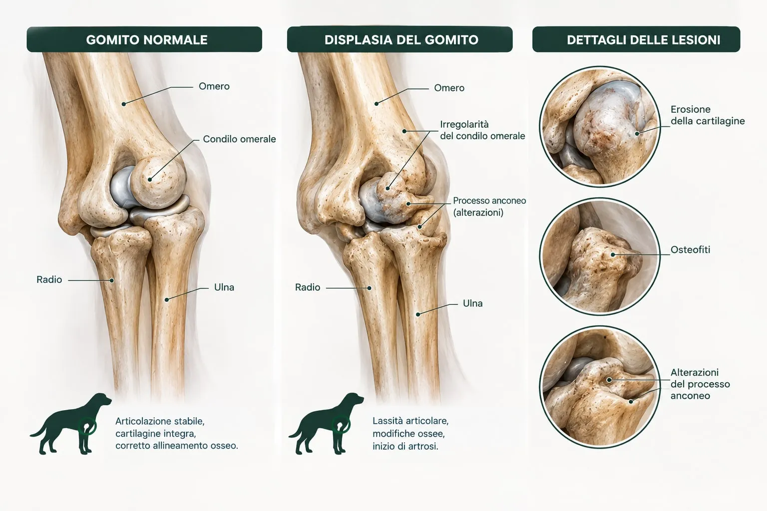 Confronto anatomico fra un gomito canino normale e uno displasico, con i tre dettagli delle lesioni: erosione della cartilagine, osteofiti e alterazioni del processo anconeo